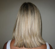 after treatment