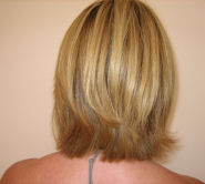 after treatment
