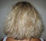 before treatment
