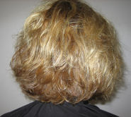 before treatment